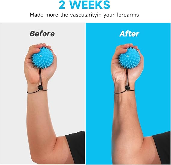 Hand Grip Strenthener - Squeeze Balls for Hand Therapy Set (5LB+10LB), Hand Exercise Ball for Physical Therapy, Elderly, Weak Hand, Arthritis, Stroke, Carpal Tunnel